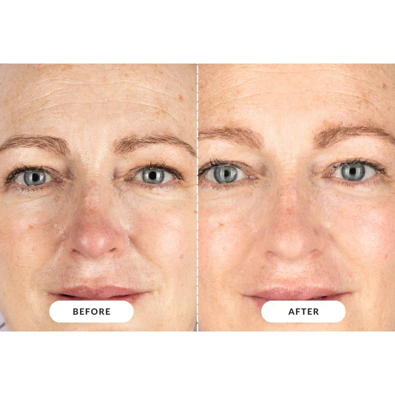 7 IN 1 Light Therapy Face Mask - Eritas London