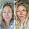 Eritas™ 5-in-1 Skincare Wand - Eritas London